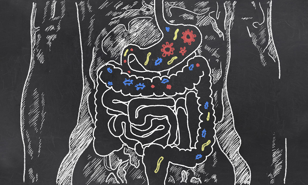 Understanding Your Screening Options for Colon Cancer