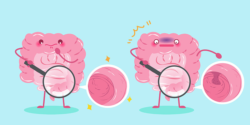 Cartoon intestine finds a polp on itself with a magnifying glass